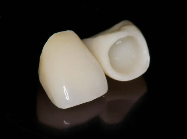 ジルコニアクラウンA