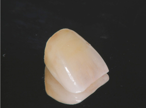 ジルコニアクラウンB