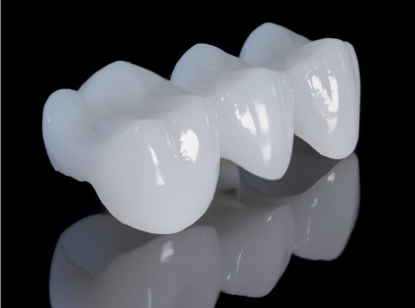 オールセラミックスクラウン