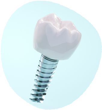 安心のインプラント・ブランド