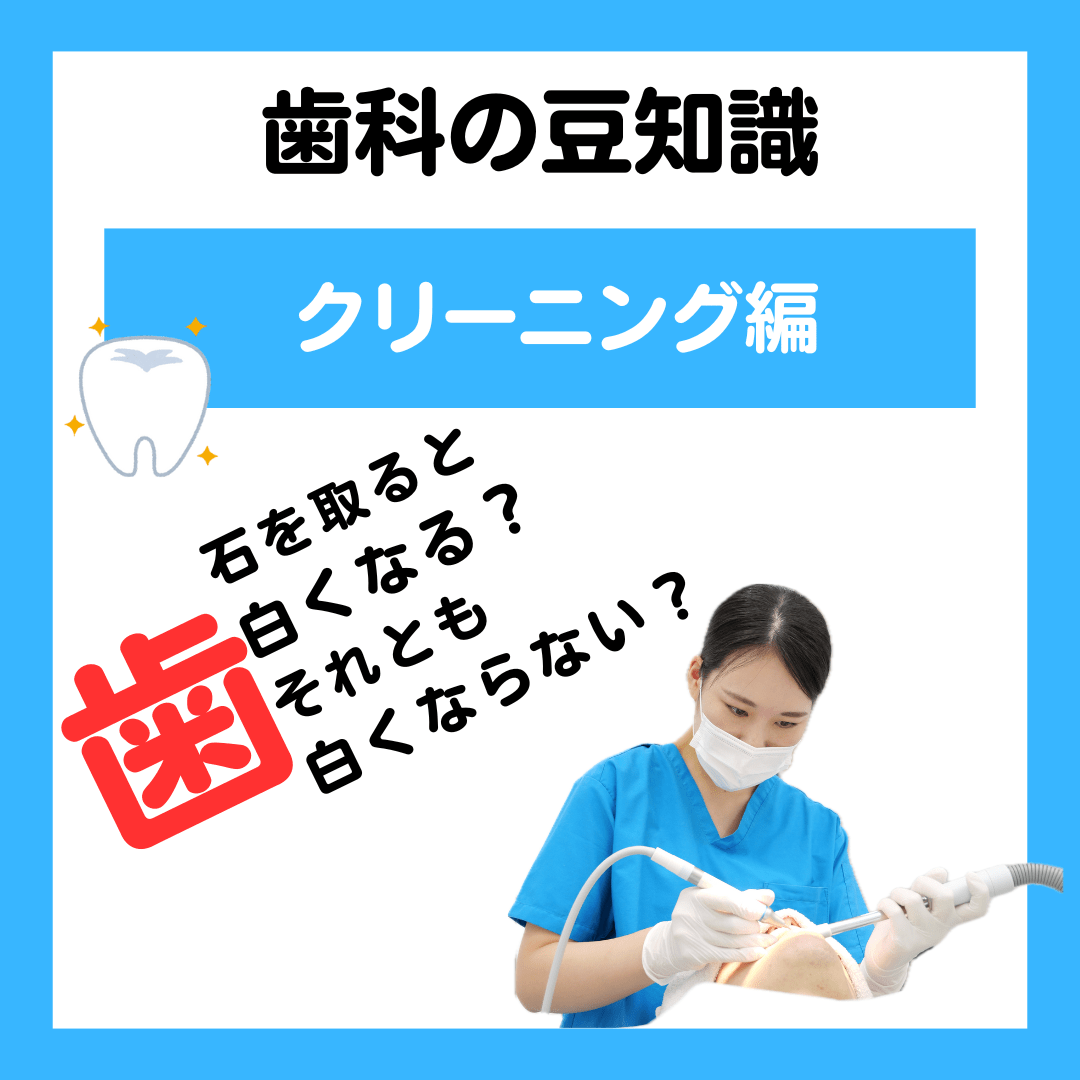 歯石を取ると白くなりますか？